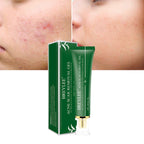 Acne Scar Gel visibly reduces marks and prevents new breakouts.