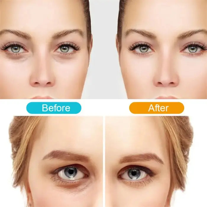  Before and after photos highlighting smoother skin and reduced dark circles from 3-in-1 eye device.
