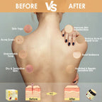 Bee venom cream before and after skin results showing reduced acne, even tone, and hydration.