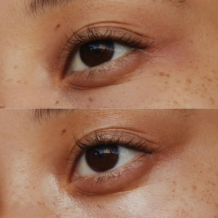 Clinical before and after results showing reduced under-eye wrinkles and improved skin texture with nourishing eye cream