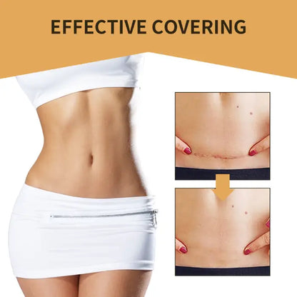 Effective scar-covering patch shows dramatic results on abdominal scars, enhancing skin appearance.