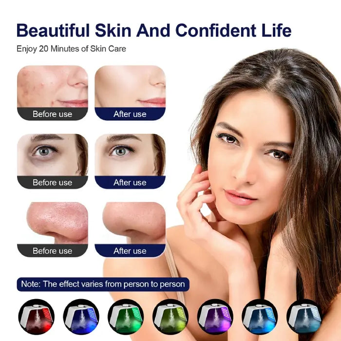 LED light therapy device before and after skin improvement comparison images.