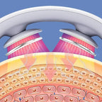 Neck massager showing infrared light therapy penetrating skin layers for deep tissue relaxation.