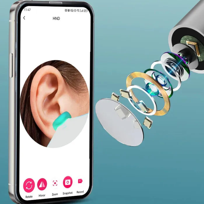 Smartphone app showing a 100° viewing angle for ear cleaning with super-fast WiFi.