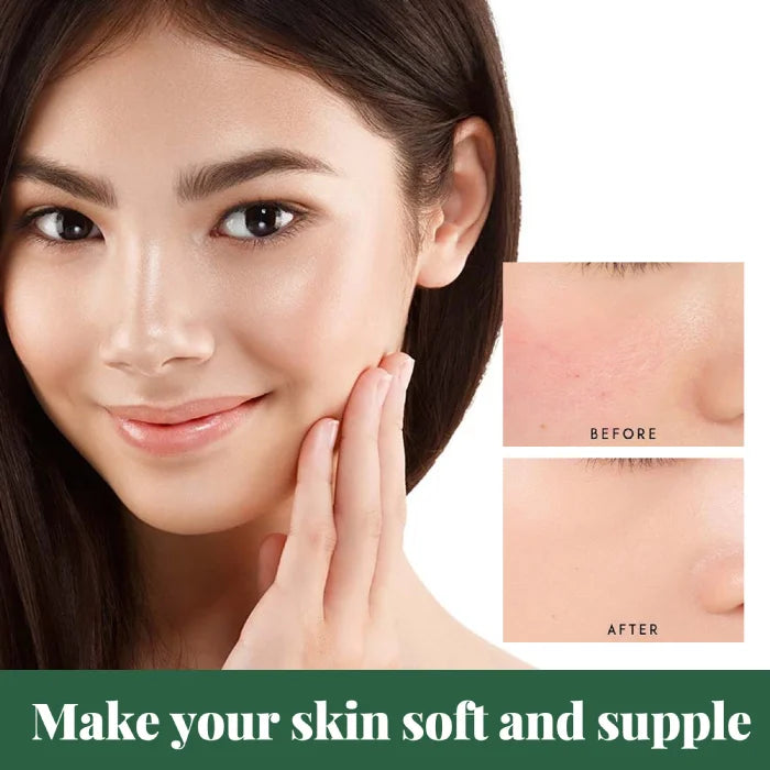 Visual results of using skincare for softer and suppler skin.