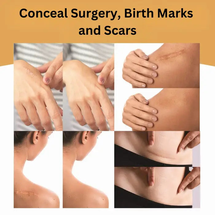 Versatile scar-covering patch for various scars, including surgery marks, showcased with impressive before and after results.